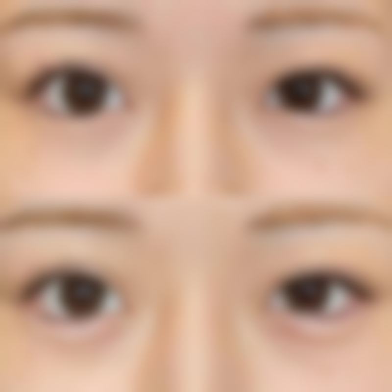 烟台莱阳悦美人整形医院医生团队实力与技术优势分析