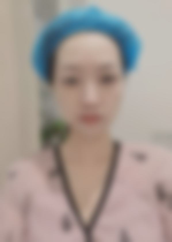 杭州素颜医疗美容门诊部光子嫩肤全模式体验案例+价格，医生灵活调能量无推销，肤感细腻透亮，效果惊喜又安心
