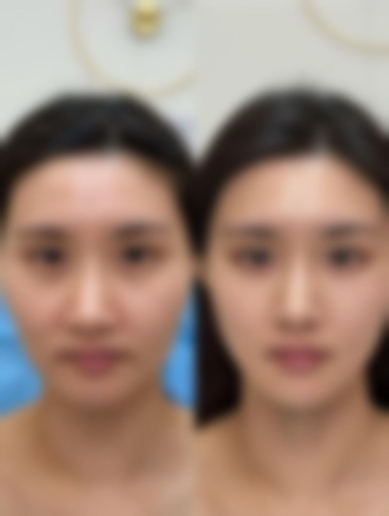 贺姽娟医生擅长领域及核心技术优势详解