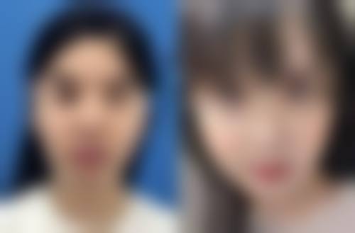总结:理性看待植发,科学守护秀发
