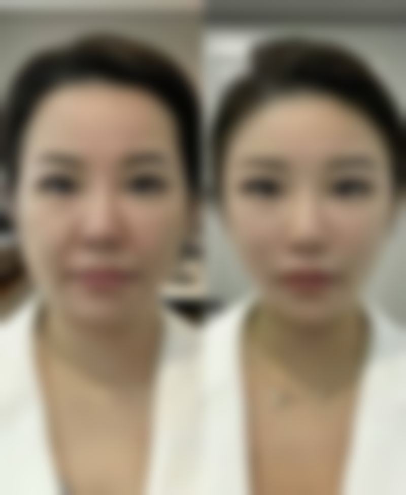 金信淑的临床优势与安心保护体系