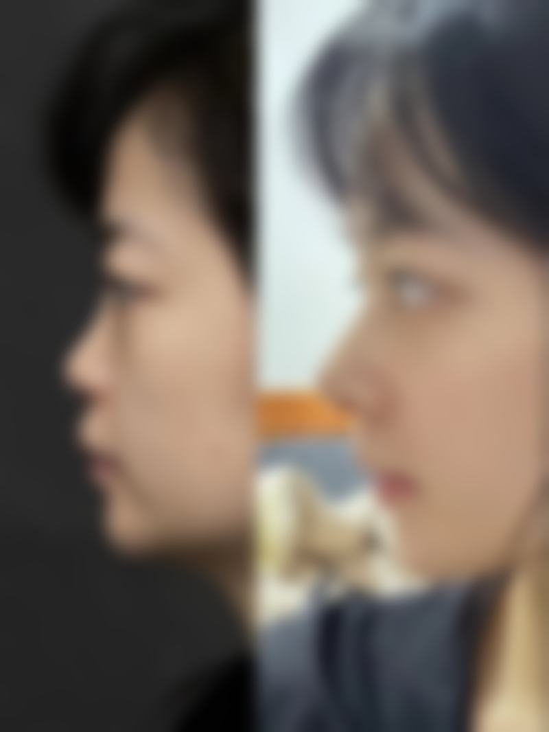 热门项目深度解析与实例分享