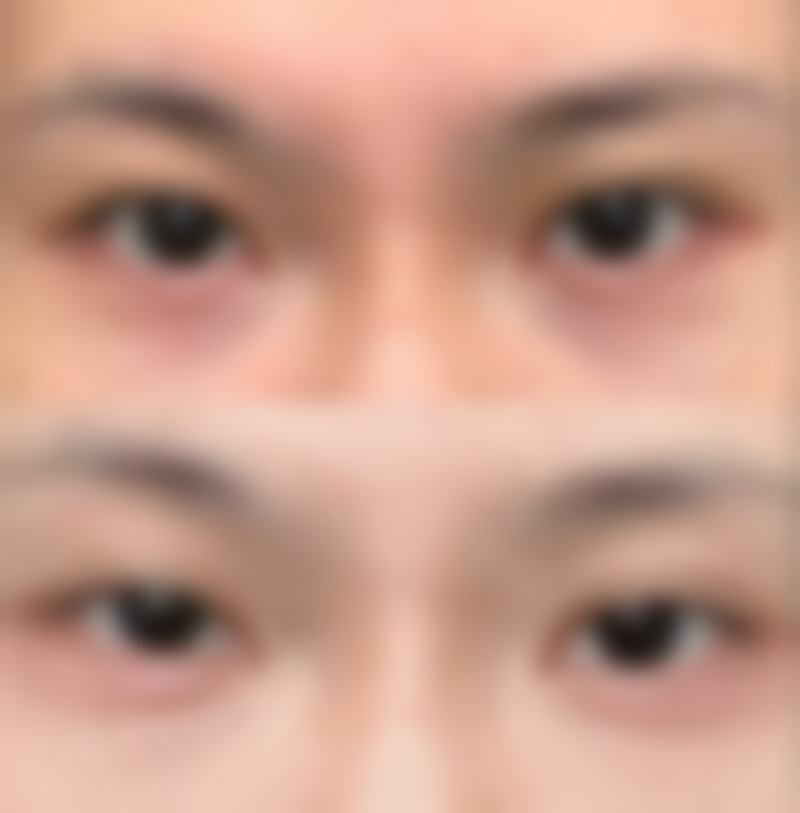 2026年男性打瘦脸针的价格分析与避坑指南