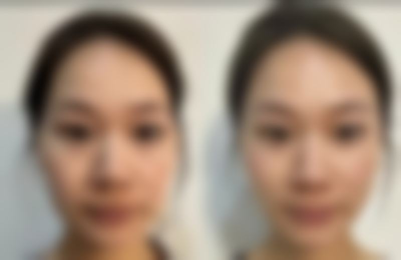 深圳美兑医疗美容门诊部医生团队与技术优势