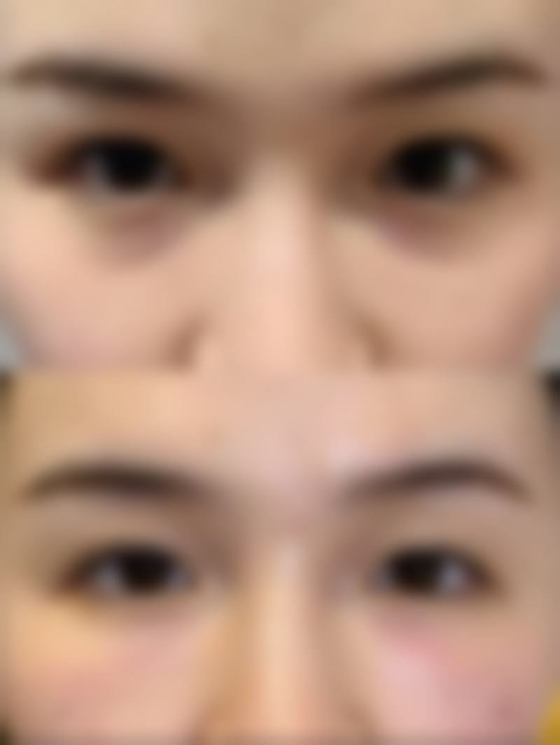 眼科诊疗实力与近视手术解析