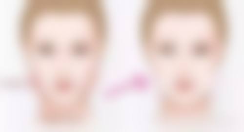 2026年做眼袋真有后遗症?揭秘三大隐患与避坑指南