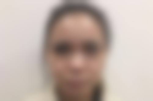 广州地区双眼皮术后美瞳线纹绣具有影响力医院推荐