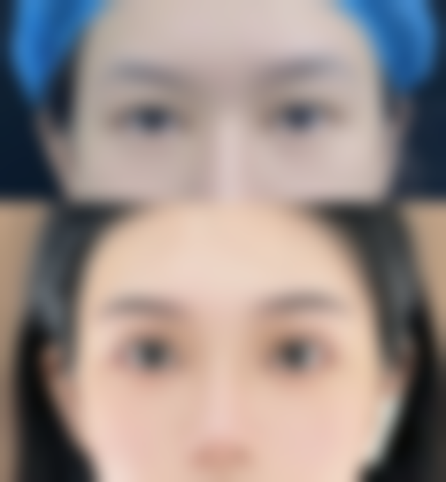 衡阳雅美整形医疗美容医院热门项目价格表与真人实例揭秘