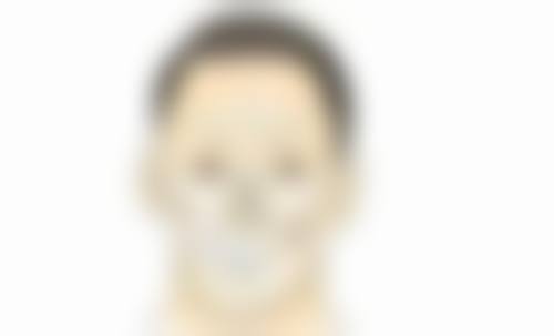 大腿抽脂一次多少毫升安心?2026年价格揭秘,韩国/郑州医生报价及抽吸量详解