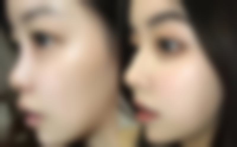 总结:科学祛疤,拥抱新生