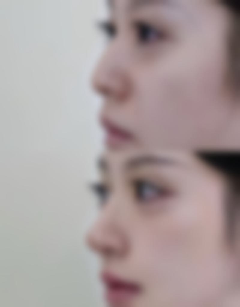 韩国ON AIR(欧艾尔)整形外科用户口碑与真实实例反馈
