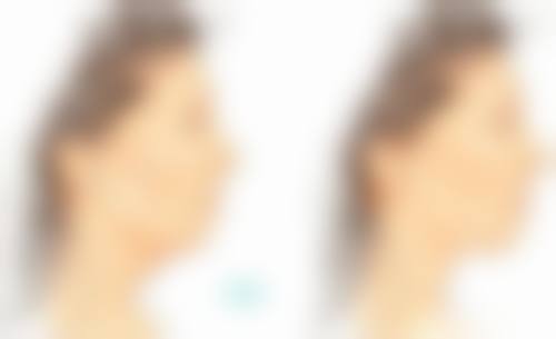 总结与展望：理性看待面膜，科学应对眼袋
