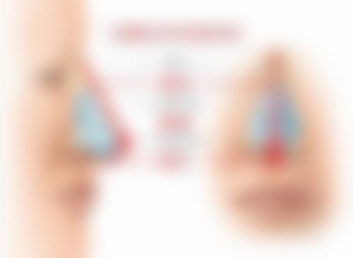 隆鼻术后侧睡相关的常见误区与价格优势解析