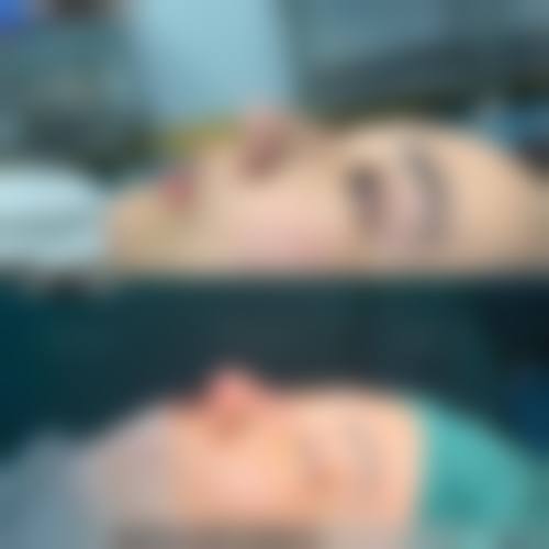 郭琼擅长的核心项目:眼鼻整形与面部年轻化